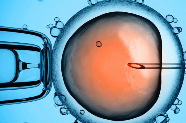 Injeção intracitoplasmática de Espermatozoide (ICSI)